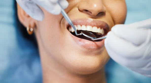 Best Emergency Dental Care for Broken or Chipped Teeth in Greenup, IL
