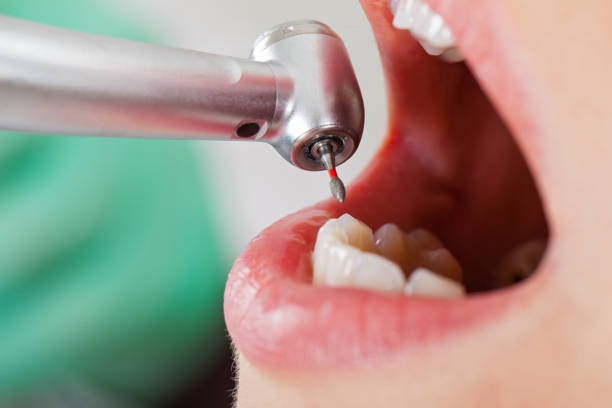 Best Emergency Dental Care for Broken or Chipped Teeth in Greenup, IL